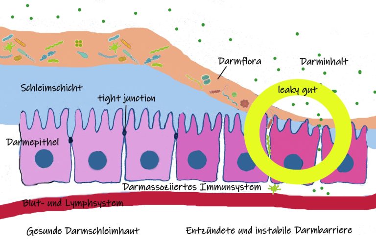 Schema eines Leaky Gut Syndroms